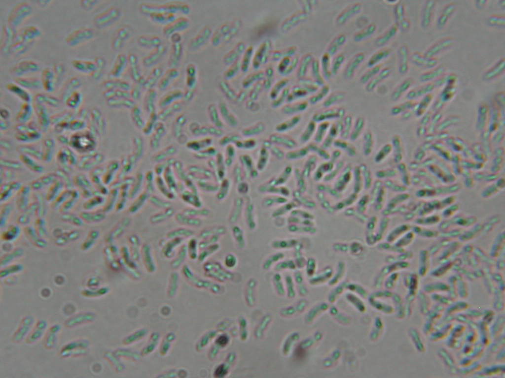 Da determinare...  (Dacryobolus karstenii)